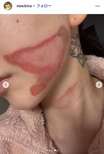 クォン・ミナInstagramより