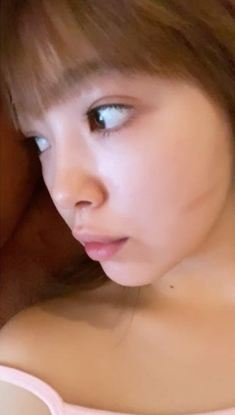 藤田ニコル、ノーマルカメラ撮影“すっぴん”に絶賛の声「肌ちゅるちゅる」火傷の痕にも言及