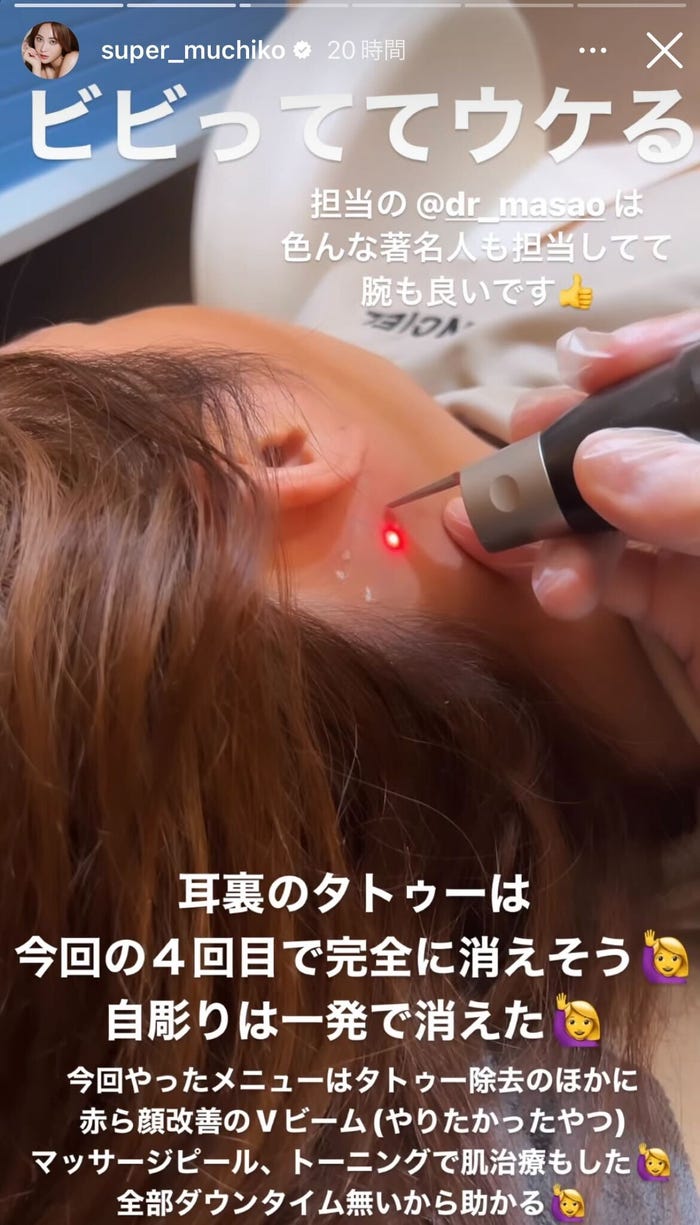 てんちむInstagramストーリーズより