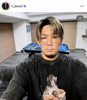 「顔、半分誰かわからんねんけどどないする？」人気格闘家・皇治が衝撃投稿 顔面腫れ、別人のような姿に・・・ネット驚き「別人すぎて」「誰？」「最初誰か分からんかった」