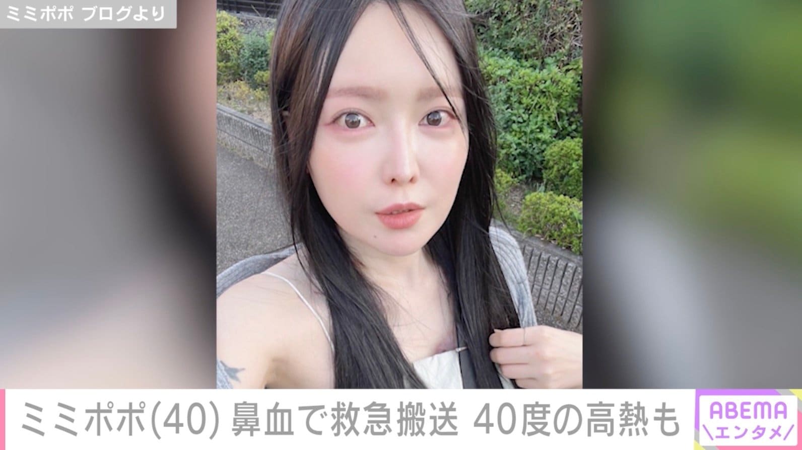 34歳で約2カ月の余命宣告・ミミポポ、鼻血で救急搬送「止まる様子がなく…」40度の高熱も
