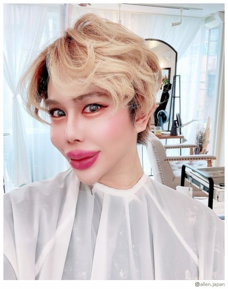 “整形費用総額1億円超え”アレン様、仲里依紗ら芸能人も虜に 人を惹き付けるカリスマ的魅力とは？