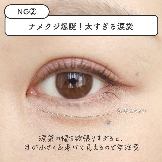 太すぎる涙袋