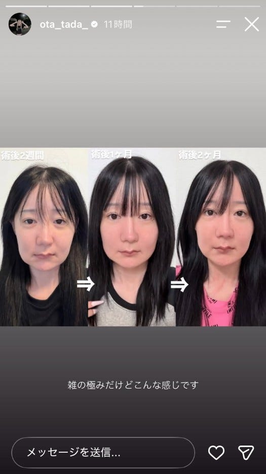 多田さんInstagramストーリーズより
