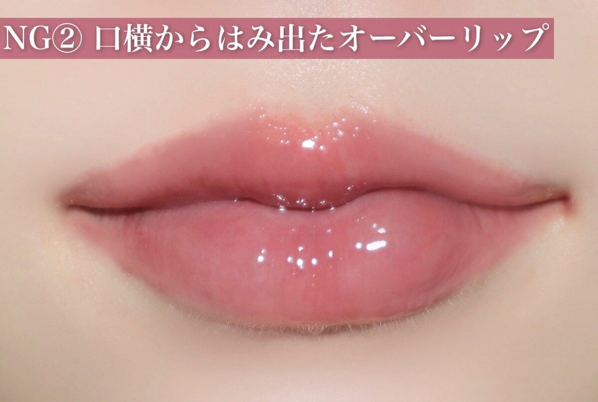 NG②口横からはみ出たオーバーリップ