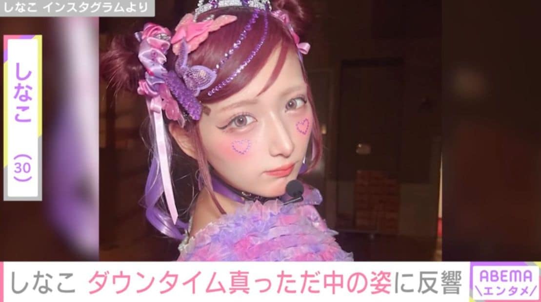 両顎の骨切り手術を受けた しなこ（30）、 ダウンタイム真っただ中の最新ショットを公開