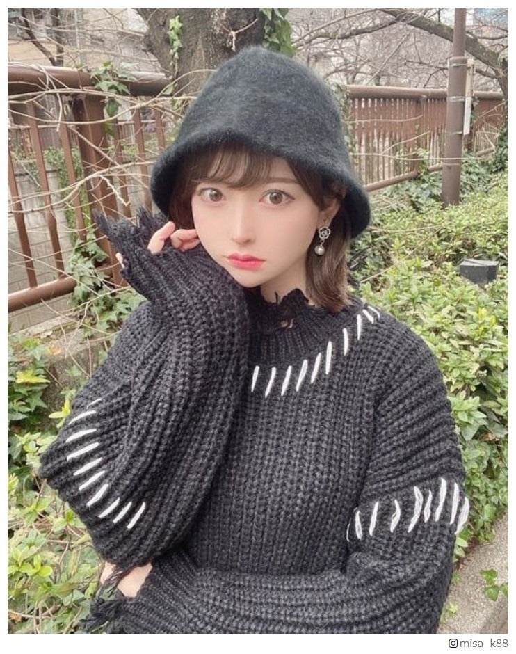 “整形総額1700万円”黒崎みさ「めちゃめちゃ後悔しています」整形での失敗告白「参考になる」「びっくりした」と反響