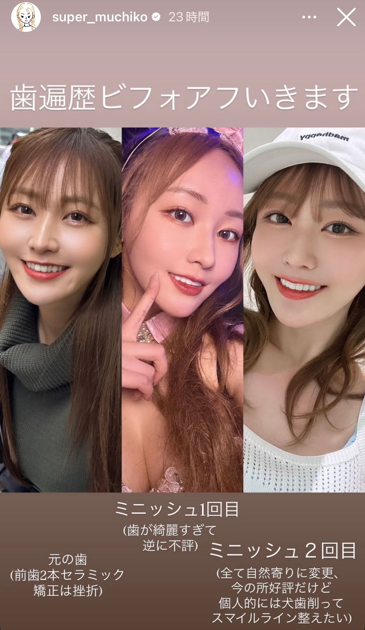 てんちむ Instagramストーリーズより