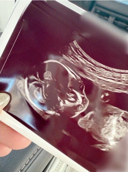 辻希美 オフィシャルブログより