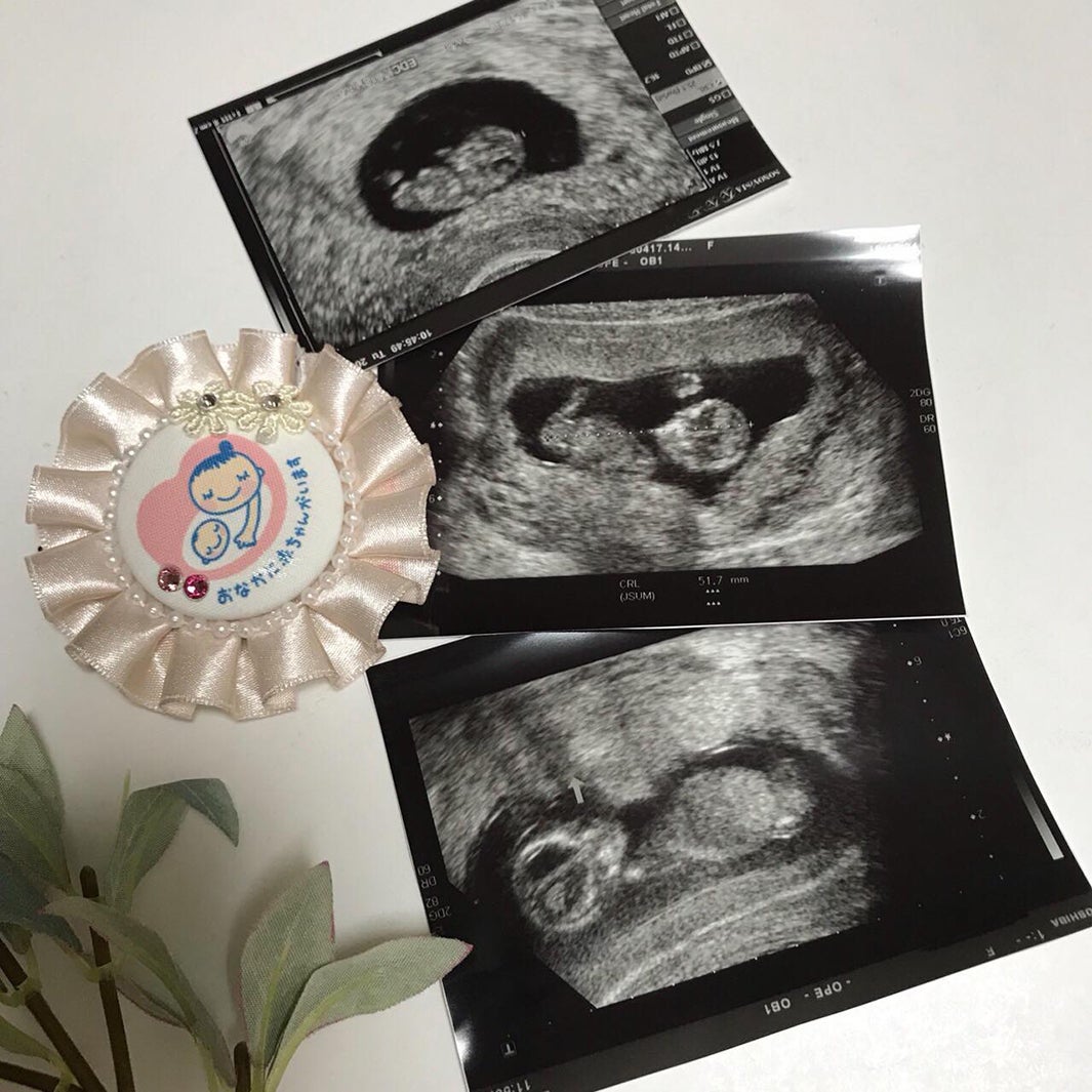 河内麻沙美が第二子を妊娠（写真提供：サイバーエージェント）