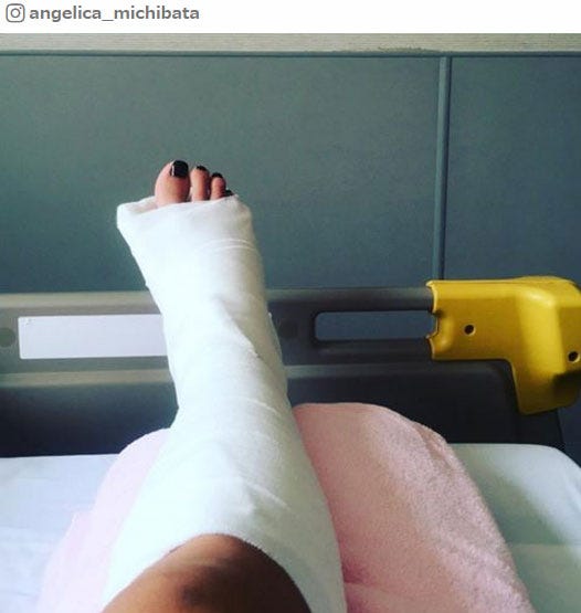 骨折でギプス姿/道端アンジェリカInstagramより