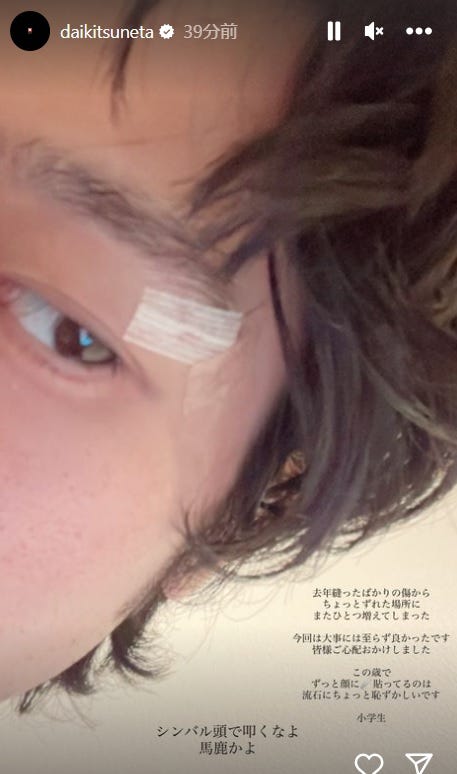 常田大希Instagramのストーリーズより