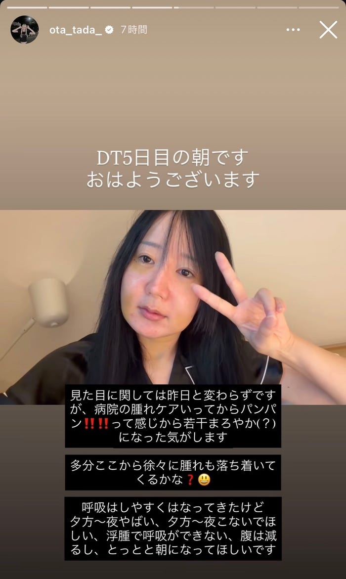 多田さんInstagramストーリーズより