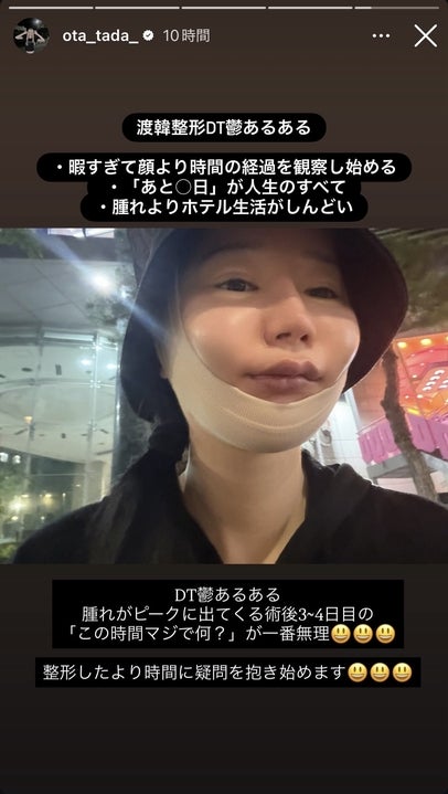 多田さんInstagramストーリーズより