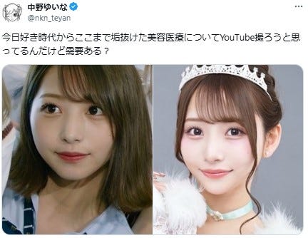 中野ゆいなXより