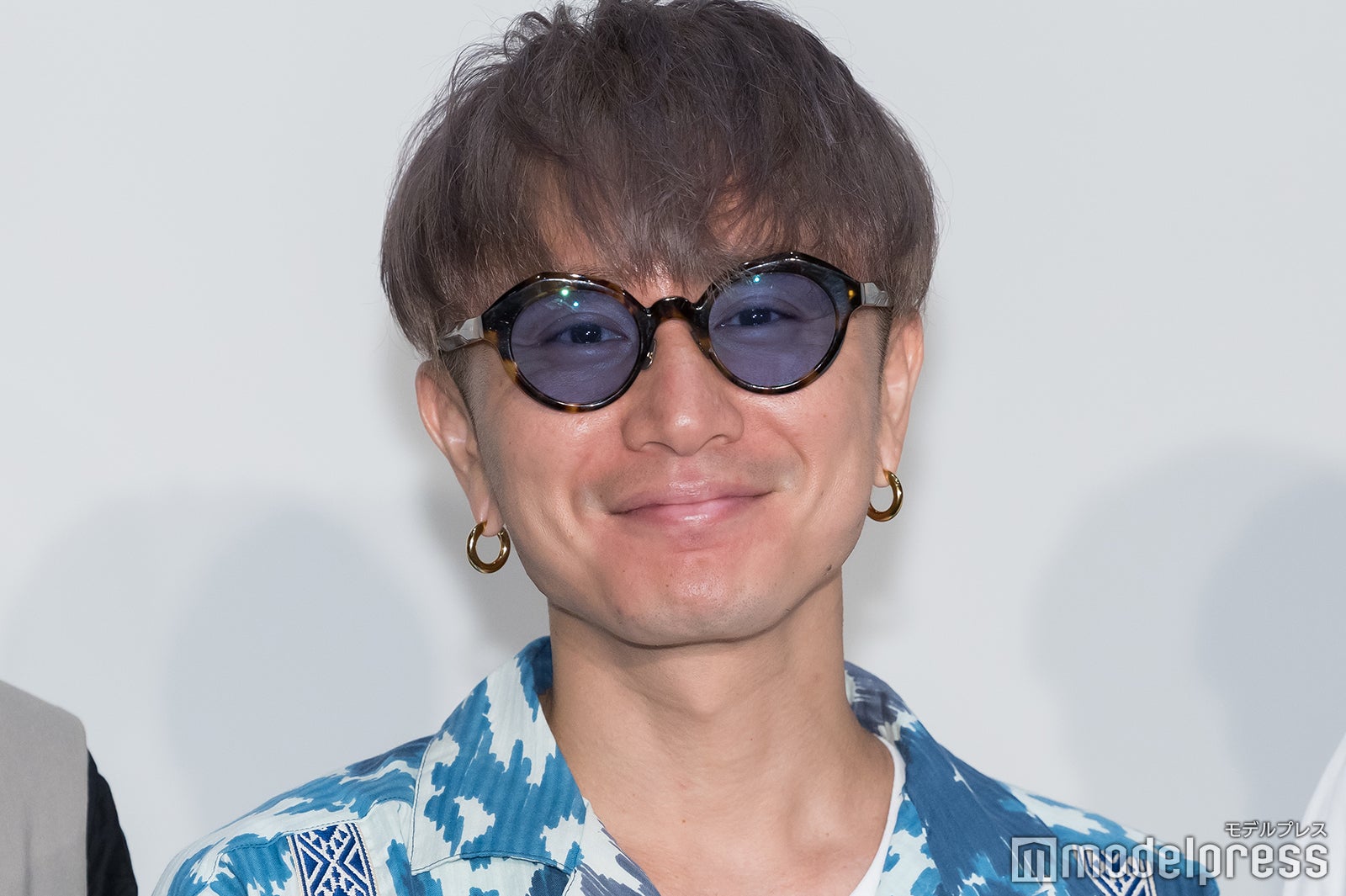 SUPER EIGHT安田章大、髄膜腫の手術後生活に変化 後遺症と向き合う日々とは「光の刺激をなるだけ少なくして」