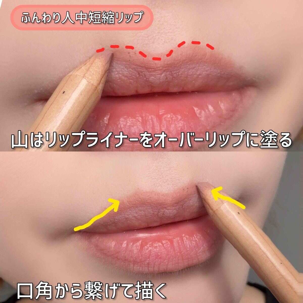 人中短縮リップ