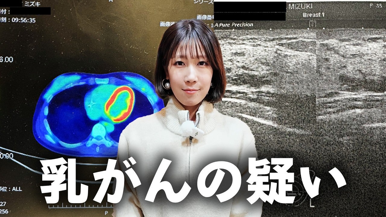 膵臓がんを公表しているYouTuber、「乳がんの疑いあり」と伝えられたと明かす