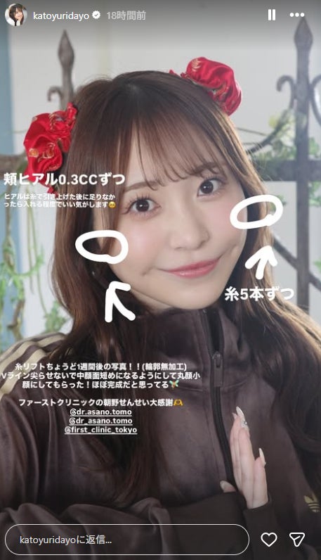 かとゆりInstagramストーリーズより