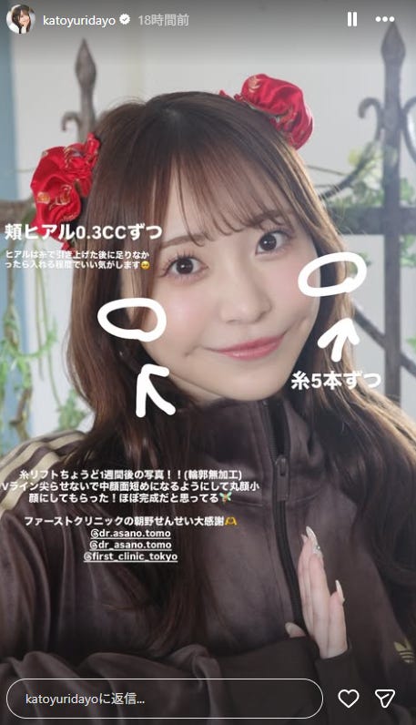 かとゆりInstagramストーリーズより