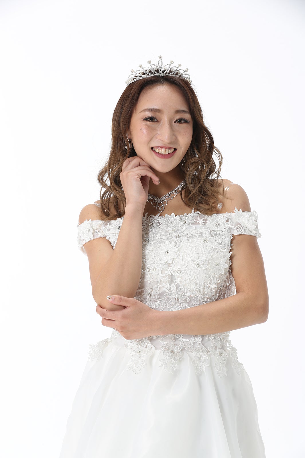 山田麻莉亜さん／整形後 （提供写真）