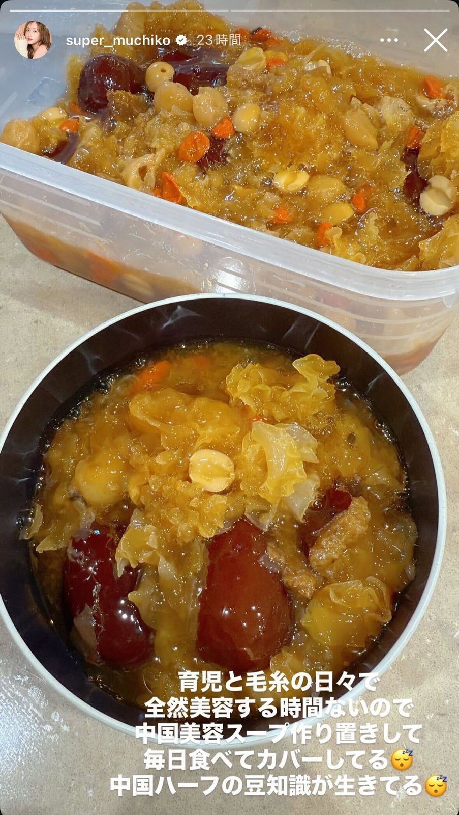 てんちむInstagramストーリーズより