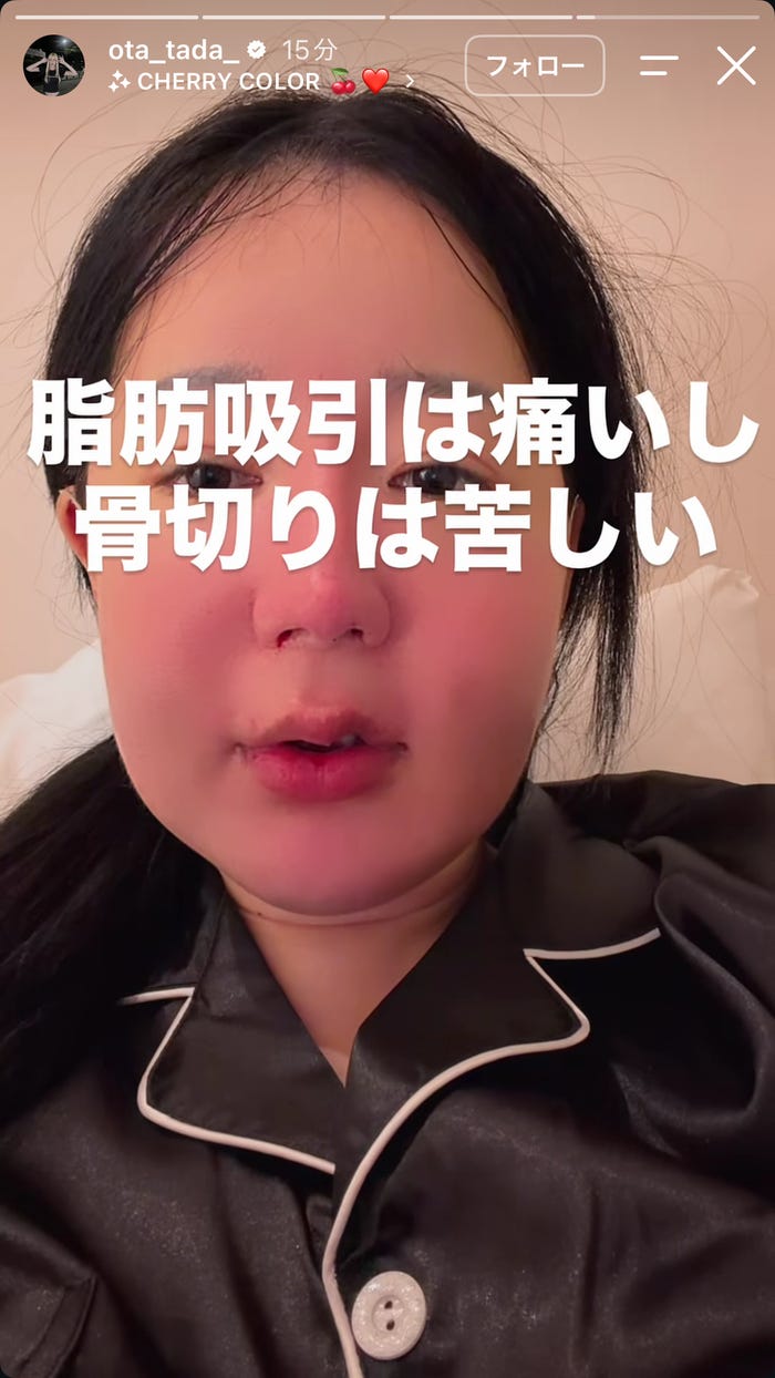 多田さんInstagramストーリーズより