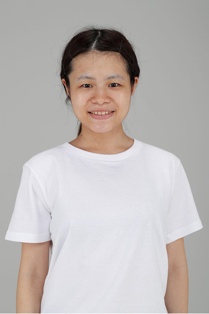 尾上七海さん/整形前 (提供写真)