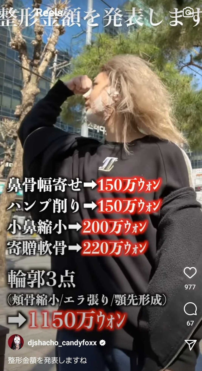 総額250万整形 のdj社長 術後1ヵ月経過報告 もっとイケメンになった 可愛い と反響 モデルプレス