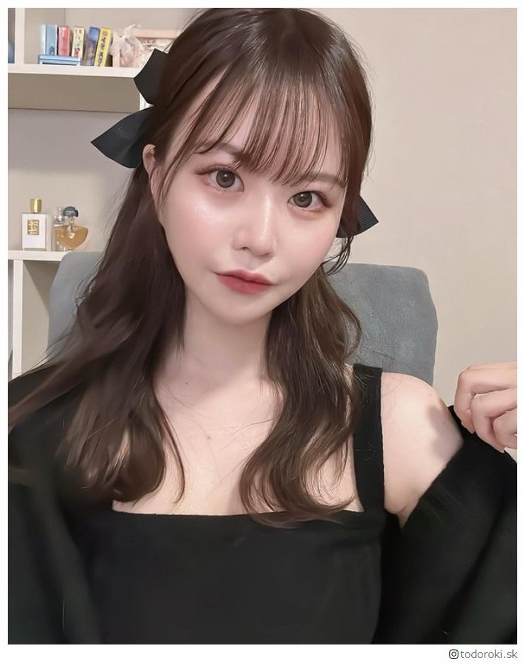 整形アイドル轟ちゃん「全部真紫になった」手術を報告 3ヶ月のダウンタイム明かす