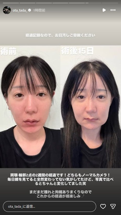 多田さんInstagramストーリーズより