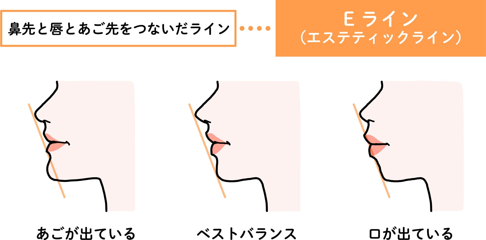 Eライン（提供素材）