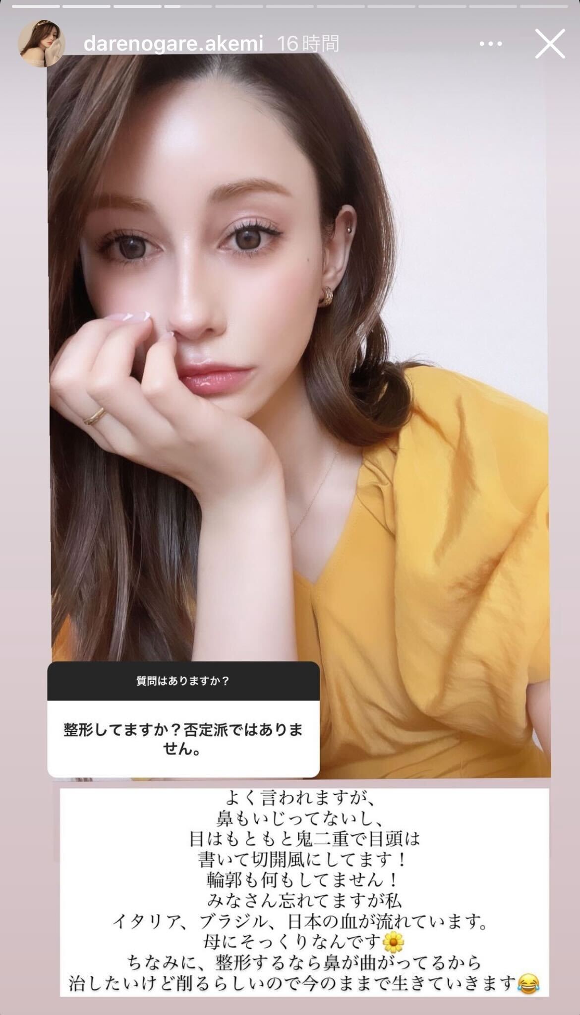 ダレノガレ明美Instagramストーリーズより