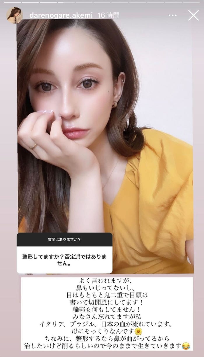 ダレノガレ明美 整形疑惑について言及 モデルプレス ダレノガレ明美 整形疑惑について言及 モデルプレス