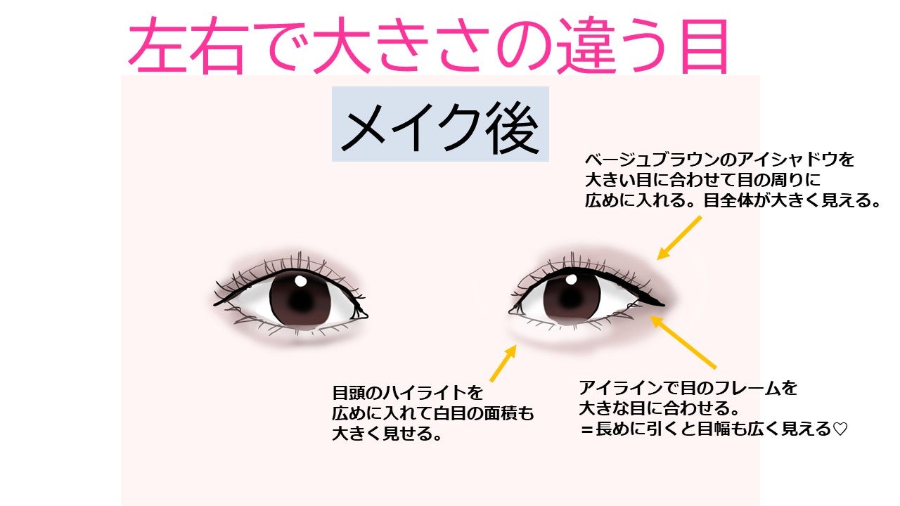 コレクション 左右 目の大きさ 違う 性格 左右 目の大きさ 違う 性格 Blogjpmbahegcvq コレクション 左右 目の大きさ 違う 性格 左右 目の大きさ 違う 性格 Blogjpmbahegcvq