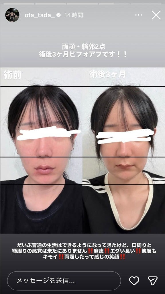 多田さんInstagramストーリーズより
