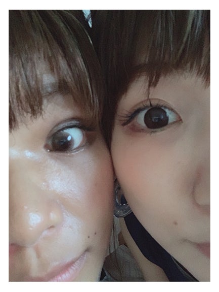 整形公表の「あいのり」クロ、桃と“埋没法による二重”比較2ショット