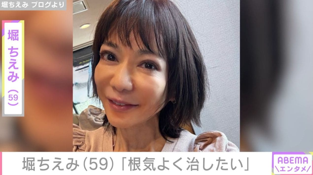 堀ちえみ（59）「油断はせずに根気よく治したい」2カ月悩まされた原因不明の体の異変