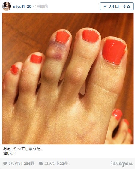 怪我を報告/Instagramより