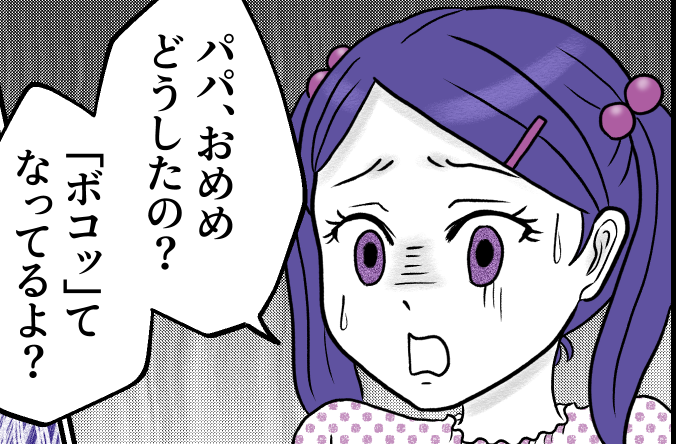 ＜イケメン夫は戦力外！？＞目指せ妻モテ！念願の二重に！なのに扱いは「オムツ以下」【第2話まんが】