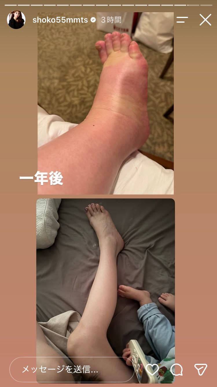 中川翔子Instagramストーリーズより