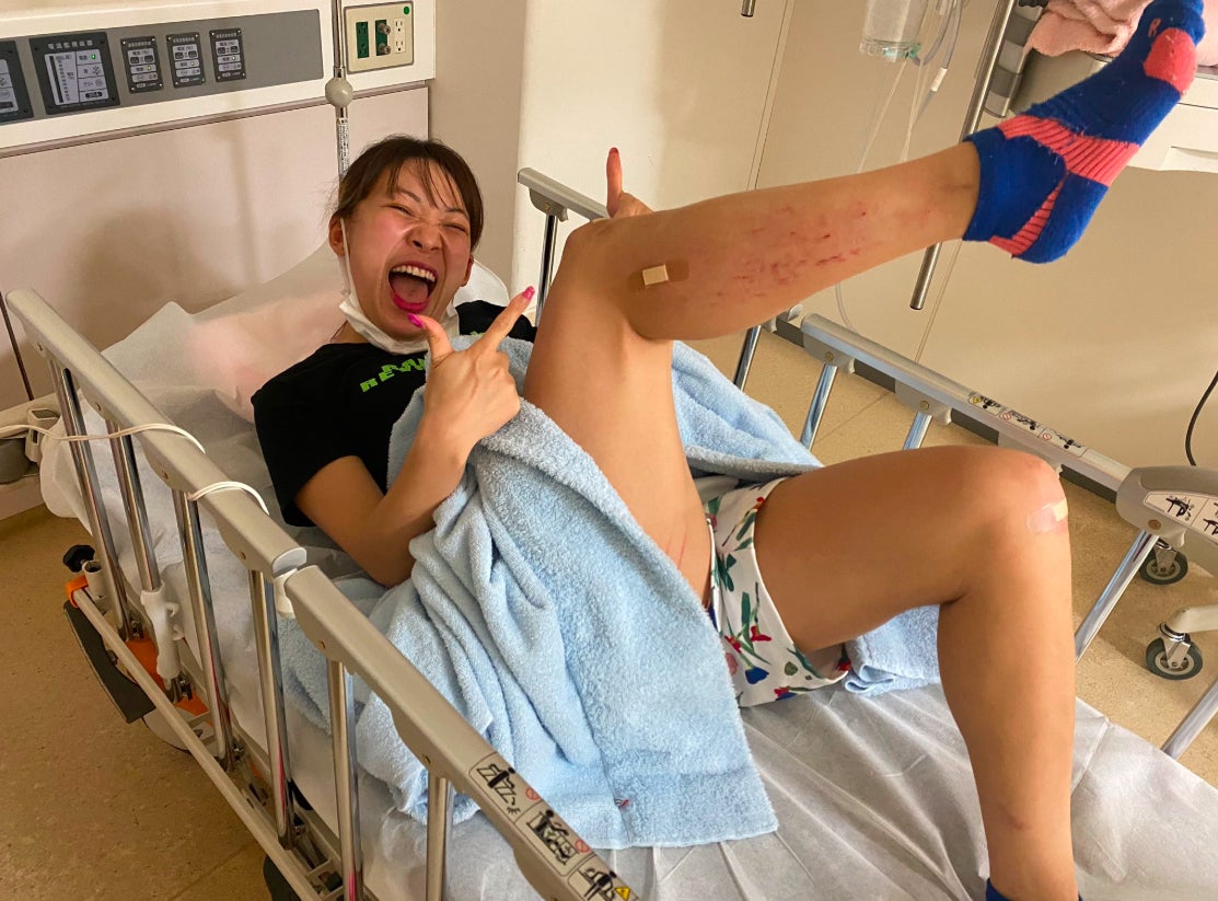 フワちゃん、交通事故の経緯詳細「スーパーにトイレットペーパーを買いに行く途中」＜本人コメント＞