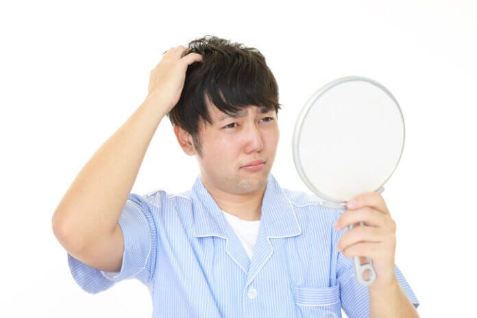 ハゲでもかっこいい人の特徴とは?