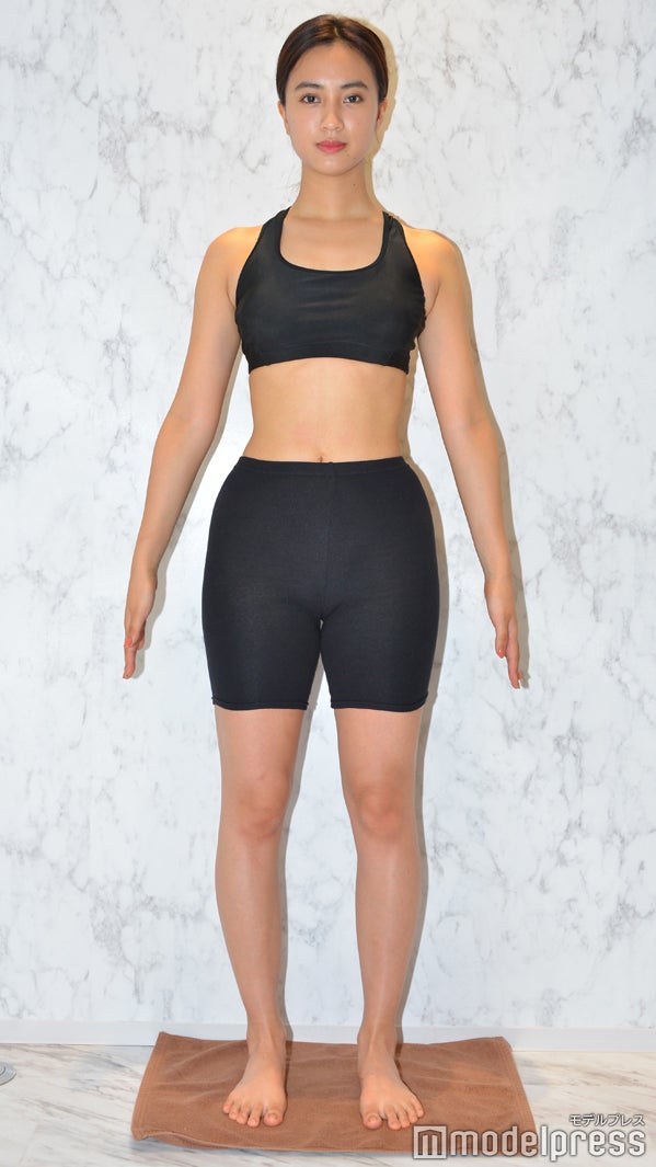 1ヶ月の施術後（C）モデルプレス