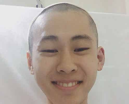 「マツコ会議」出演の“むゆあ”、交通事故で頭蓋骨骨折・手術後の姿を公開 ゆうたろうもコメント
