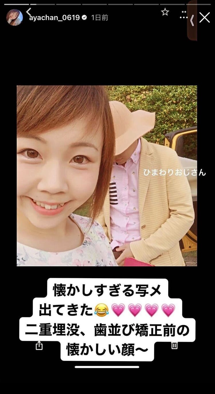 奥さん顔出し写メ 画像4/8) あやなん、二重埋没＆歯列矯正のビフォー写真公開に「素敵」「努力伝わる」の声 - モデルプレス
