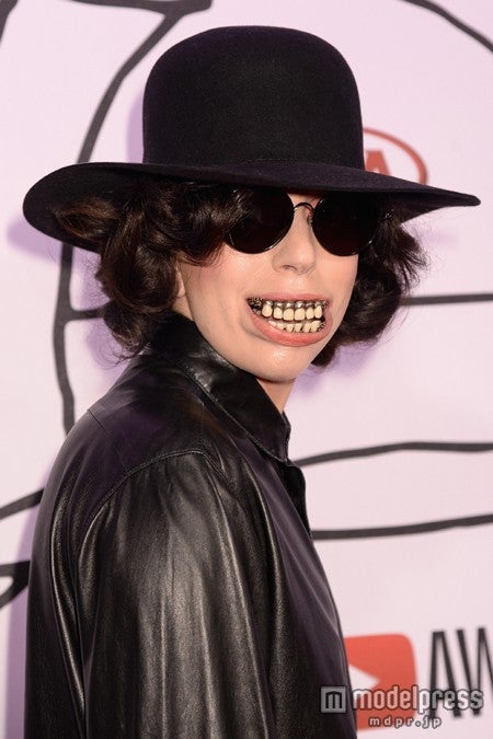 レディー・ガガ、巨大な入れ歯で口元が変形