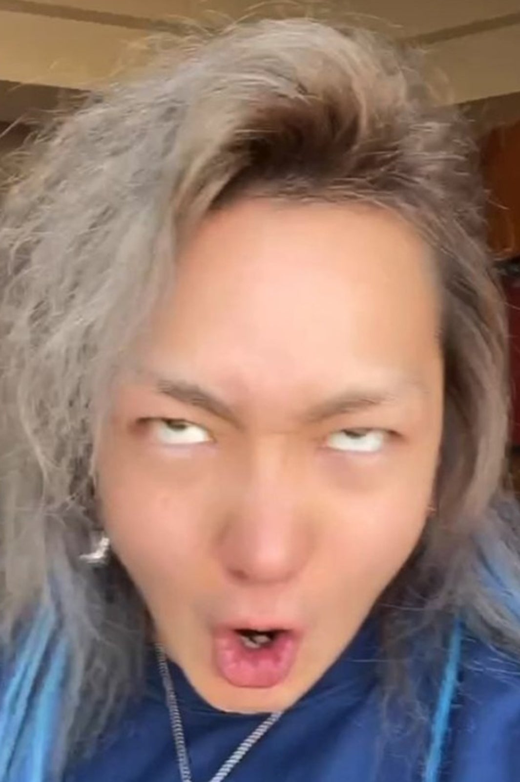 “総額250万整形”のDJ社長、術後1ヵ月経過報告「もっとイケメンになった」「可愛い」と反響