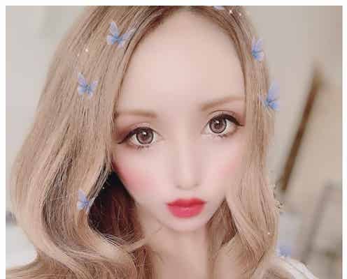 ねもやよ、“3000人に1人”病気で手術受けていた 現在の様子明かす