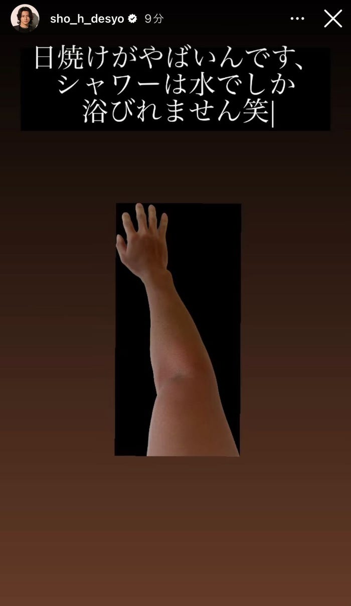 平野紫耀の日焼けした腕/平野紫耀公式Instagramストーリーズより